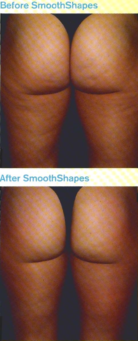 Find out more about Smooth Shapes in Charleston SC
